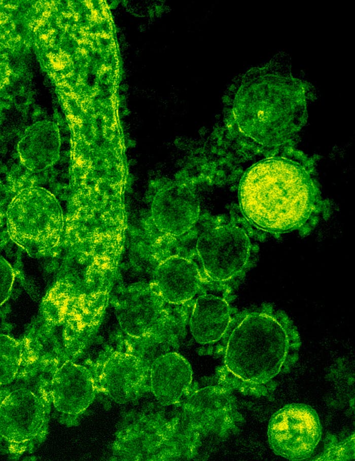 Home Green-tinted microscopic image of coronavirus particles illustrating viral structures.